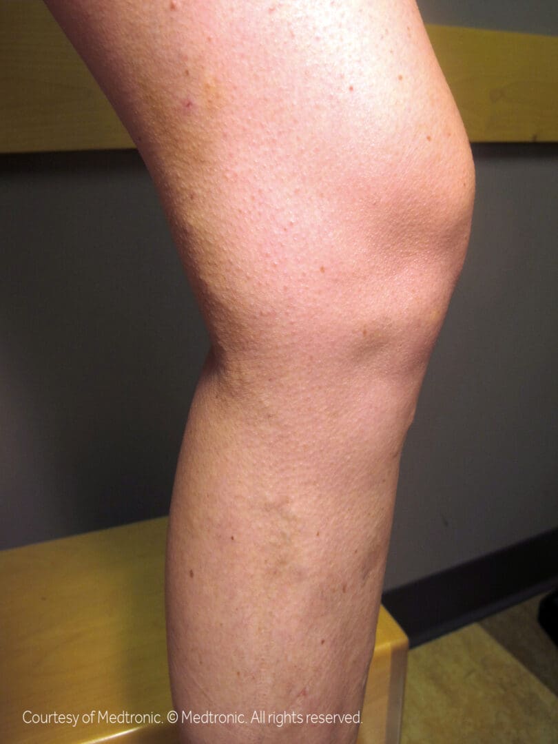 A person with a leg injury is shown.