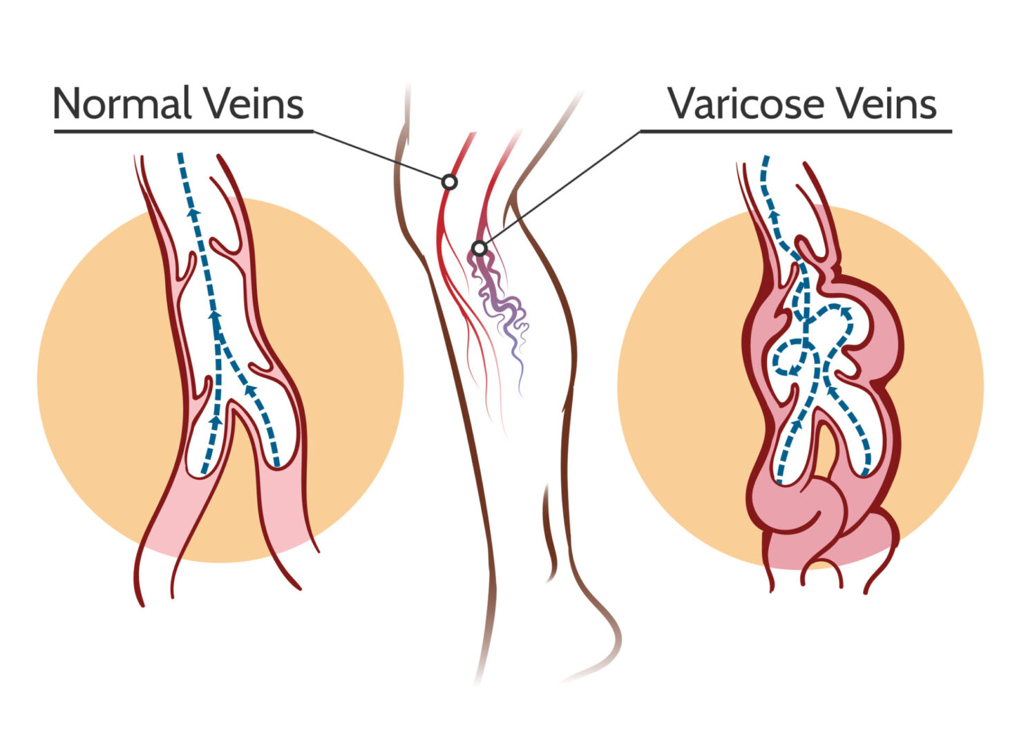 A vein is shown with the names of different veins.